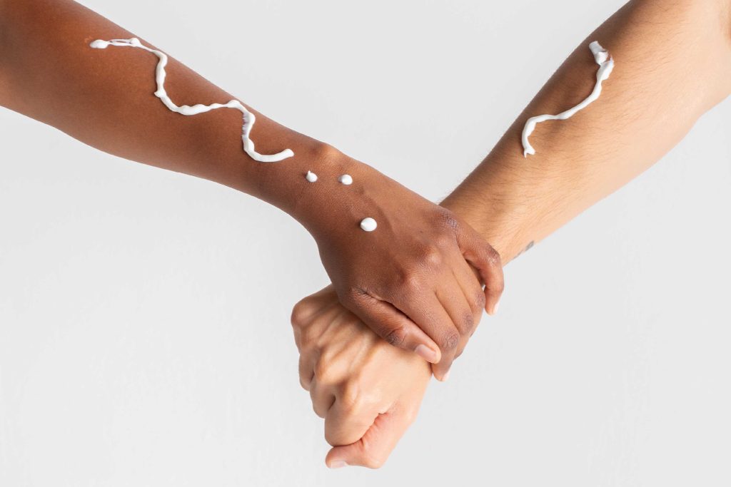 Duas mãos se segurando com creme nas pele