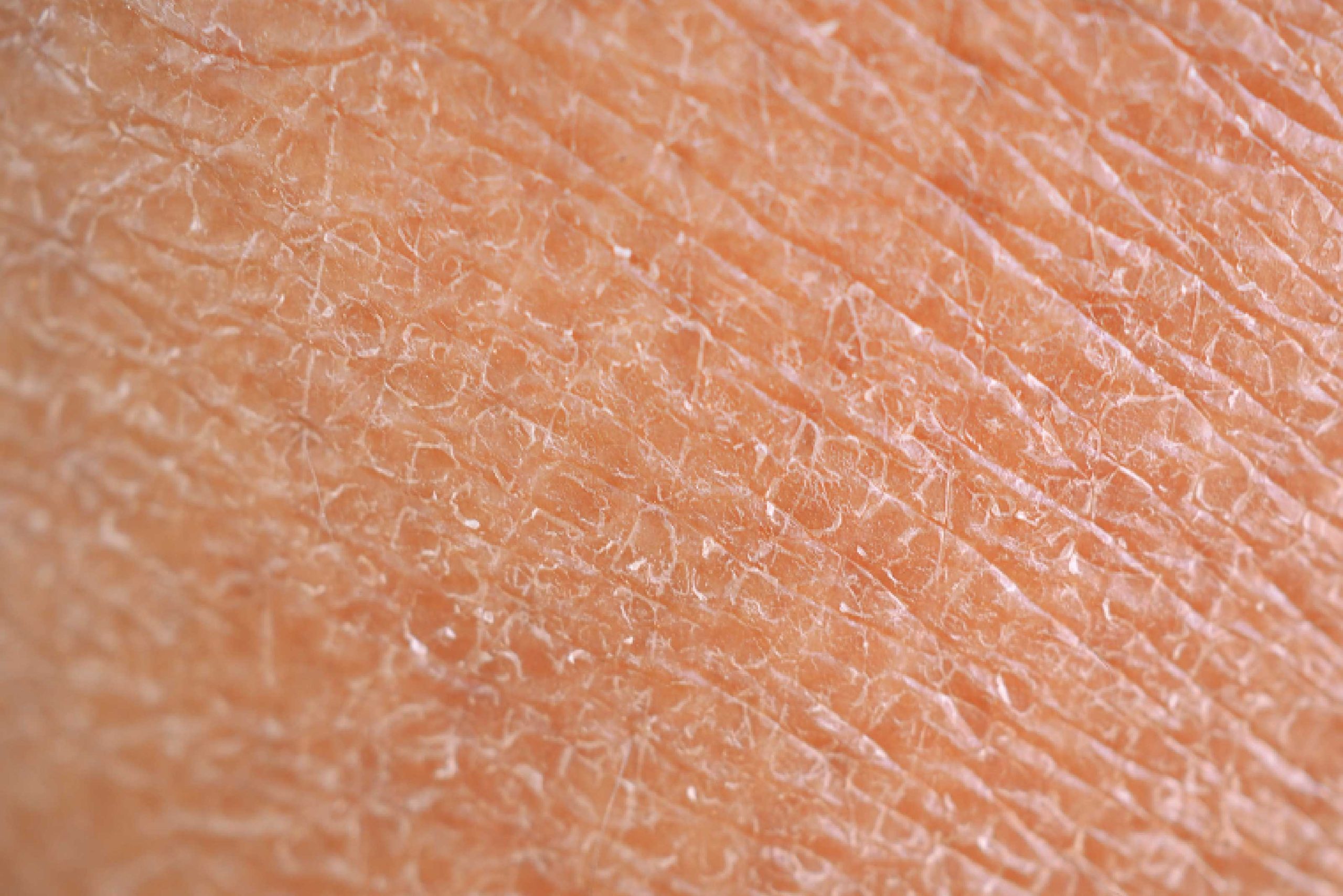 textura da pele humana em close-up