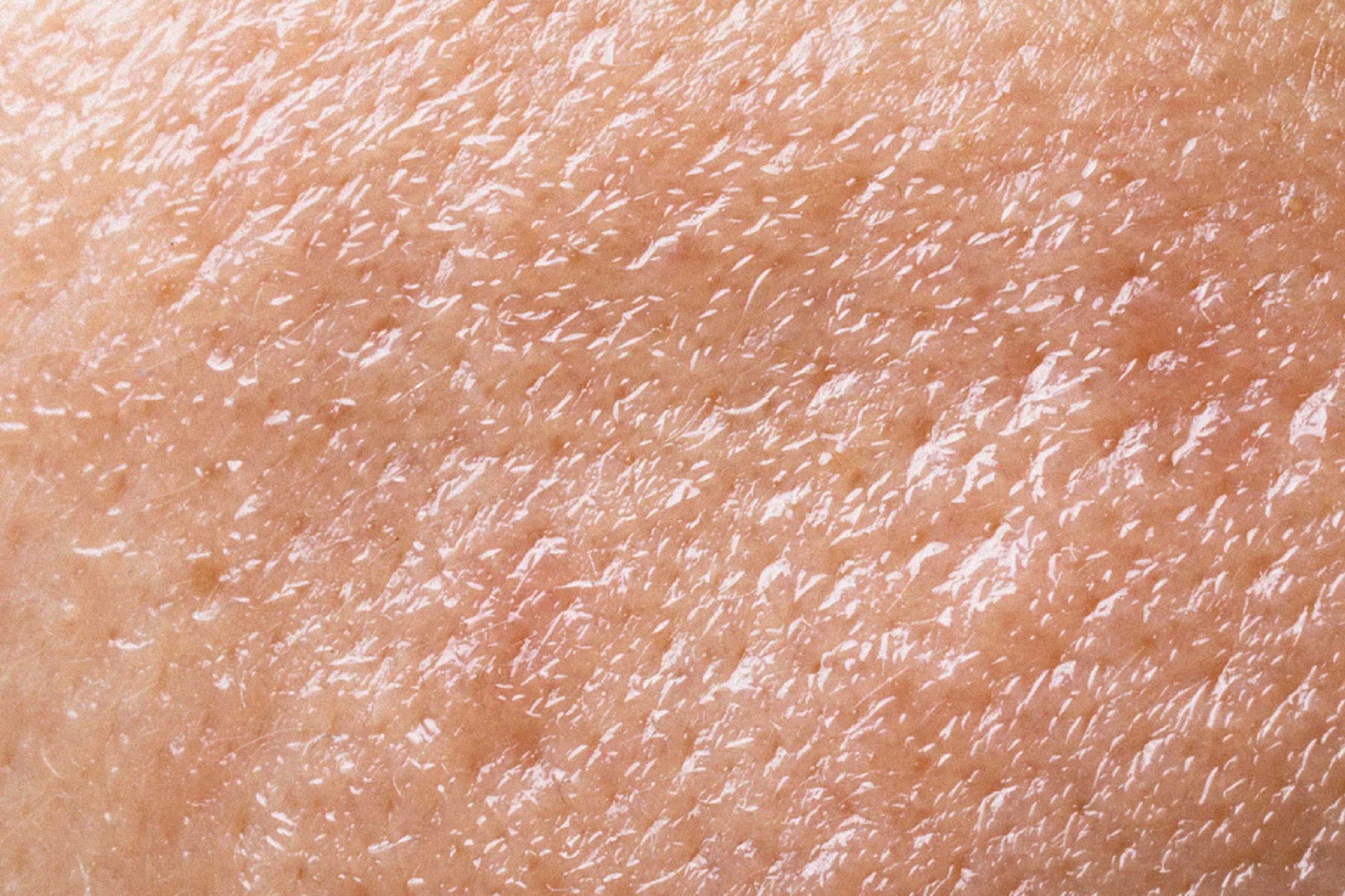 Close-up da textura da pele humana saudável.
