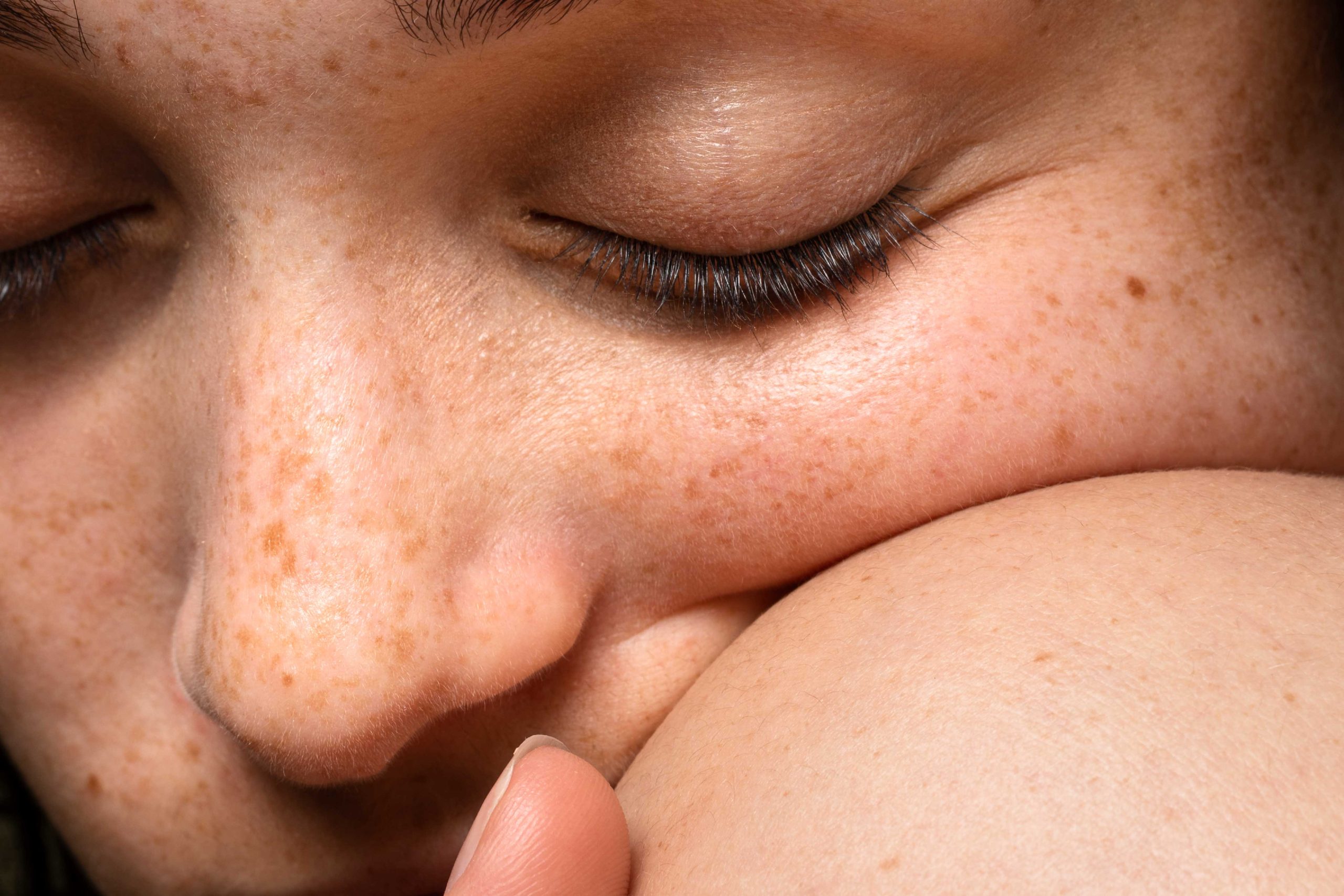 Close-up de rosto feminino com sardas e olhos fechados.