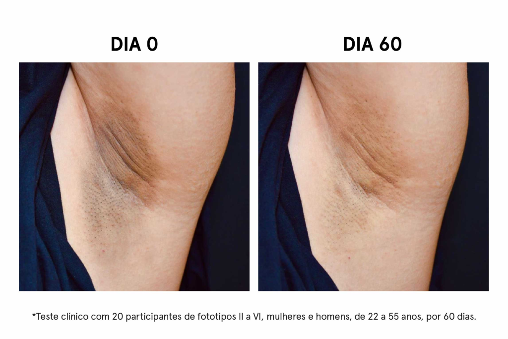 imagem_blog_8_resultados_axila