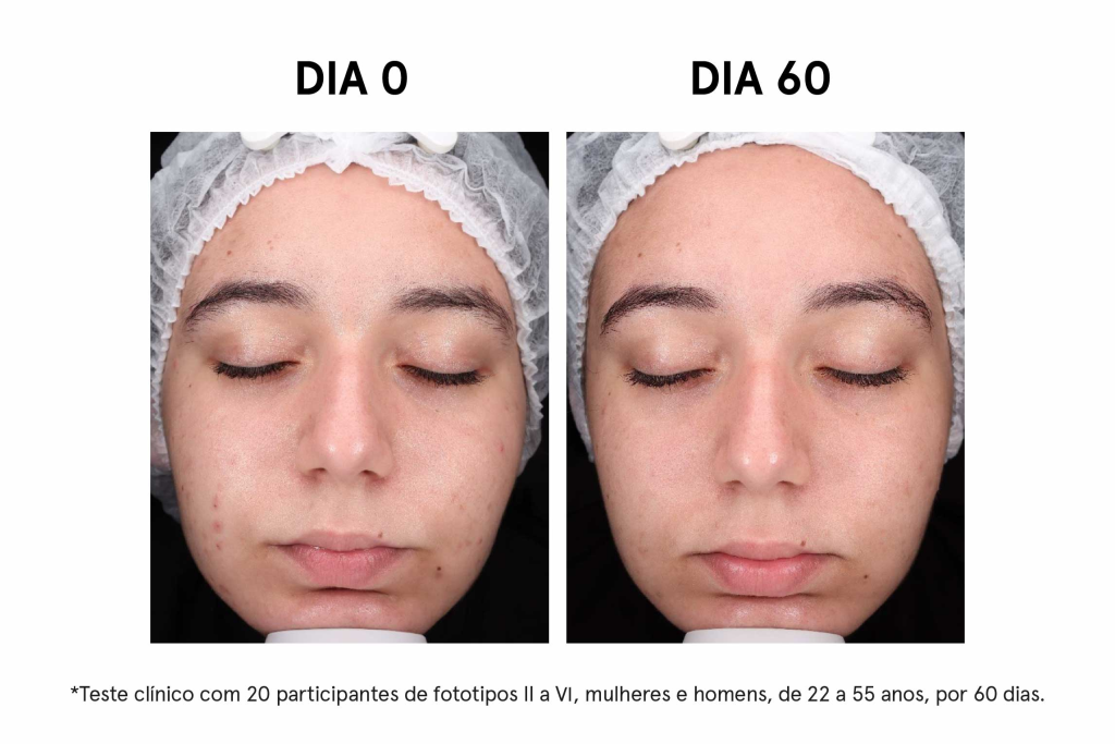 imagem_blog_7_resultados_mulher_2