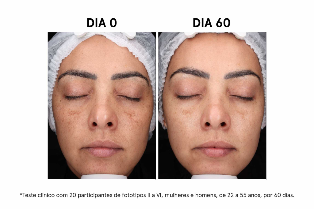 imagem_blog_6_resultados_mulher_1
